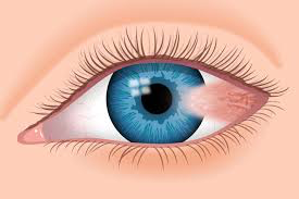 Eye Illustration